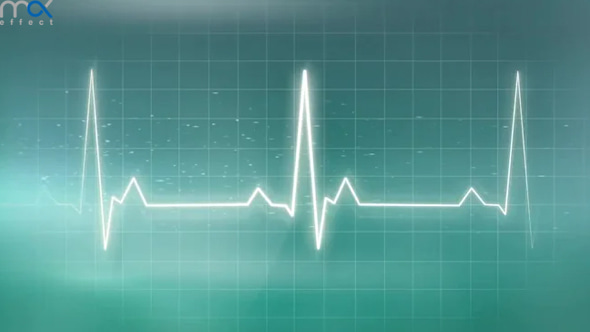 دانلود موشن گرافیک ضربان قلب